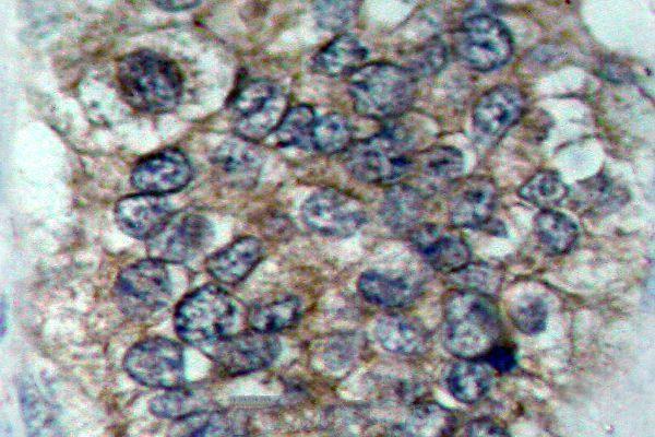 a00010y877 erbb2 primary antiboties ihc testing 2