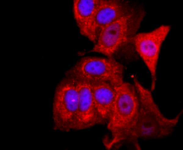 ICC staining FOXP3 in MCF-7 cells (red)