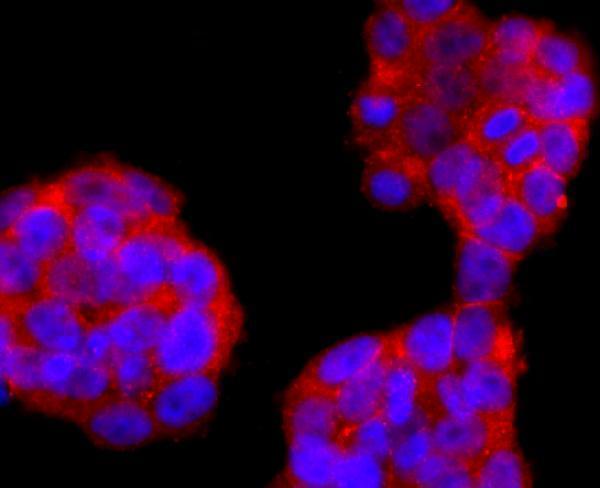 ICC staining FOXP3 in 293T cells (red)