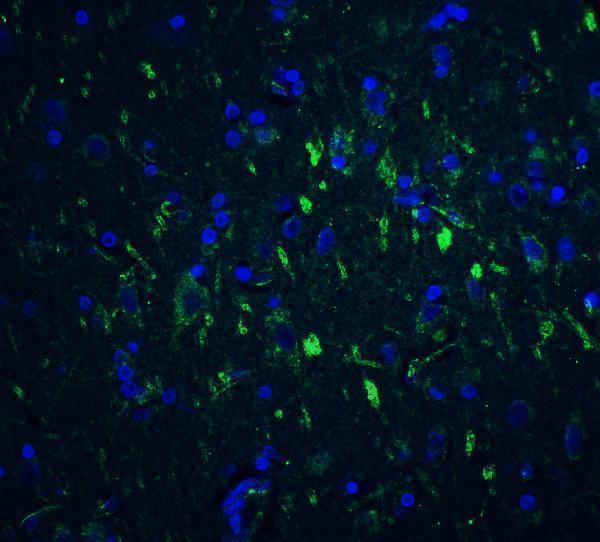 Immunofluorescence of FOXP3 in human brain tissue with FOXP3 antibody at 20 μg/mL