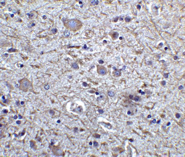 Immunohistochemistry of FOXP3 in human brain tissue with FOXP3 antibody at 5 μg/mL