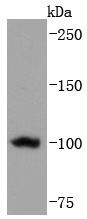Western blot analysis of TERT on Hela cells lysates using anti-TERT antibody at 1/1,000 dilution