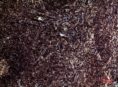 a00012 2 tert primary antibodyes ihc testing 2