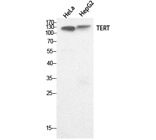 a00012 2 tert primary antibodyes wb testing 1