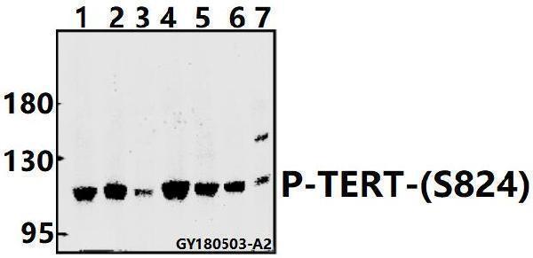 a00012s824 tert primary antiboties wb testing 1