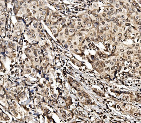  IHC analysis of HIF-1 alpha/HIF1A using anti-HIF-1 alpha/HIF1A antibody (A00013-3)