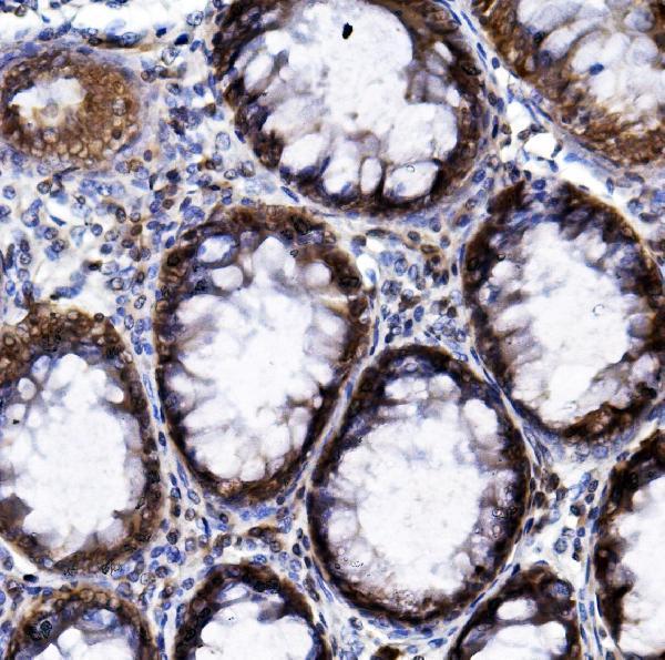 IHC analysis of HIF-1 alpha/HIF1A using anti-HIF-1 alpha/HIF1A antibody (A00013-3)