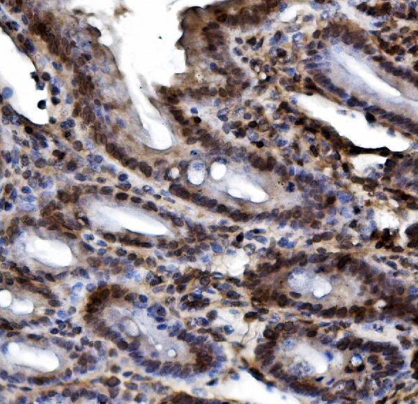 a00013 3 hif 1a primary antibodies ihc testing 4