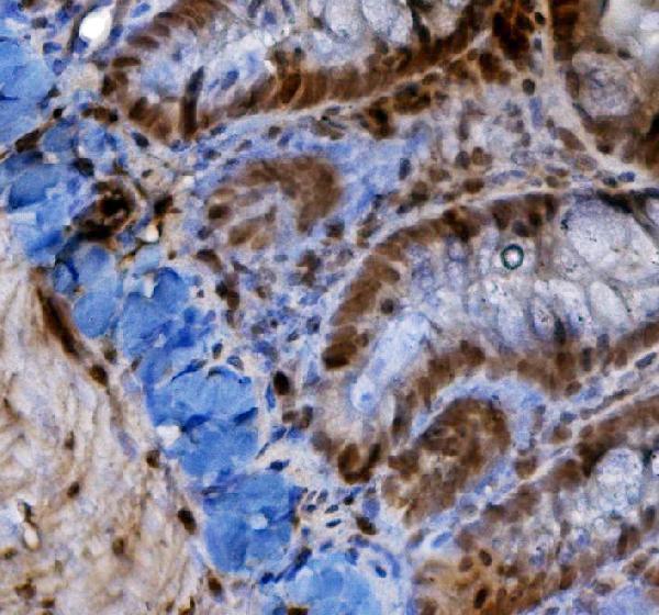 a00013 3 hif 1a primary antibodies ihc testing 5