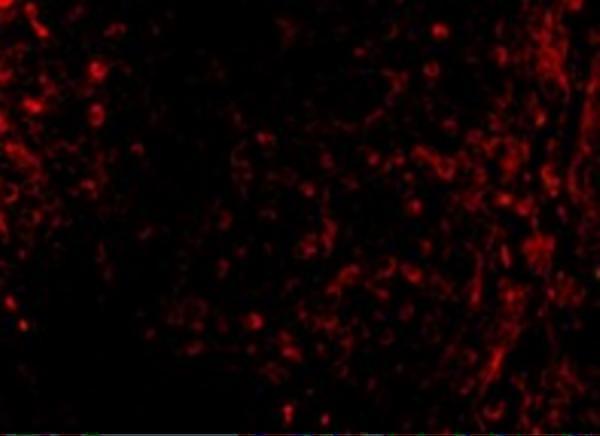 a00014 atm primary antibodies if testing 3