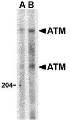a00014 atm primary antibodies wb testing 1