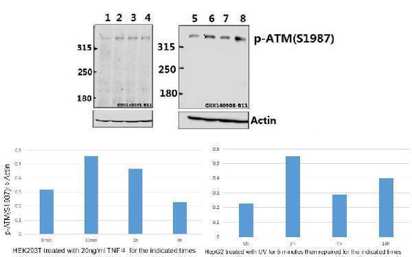 a00014s1987 atm primary antiboties wb testing 2