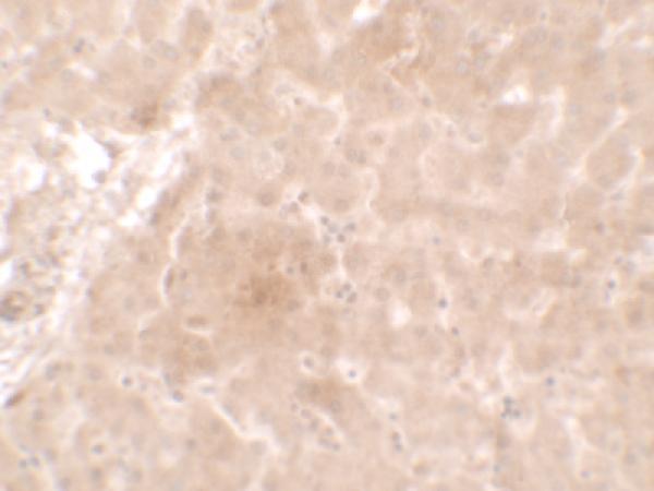 Immunohistochemistry of APO-E inhuman liver tissue with APO-E antibody at 2