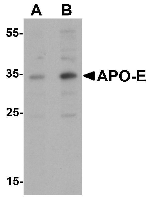 Western blot analysis of APO-E in human brain tissue lysate with APO-E antibody at (A) 0