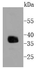 Western blot analysis of Apolipoprotein E on human kidney lysates using anti-Apolipoprotein E antibody at 1/1,000 dilution