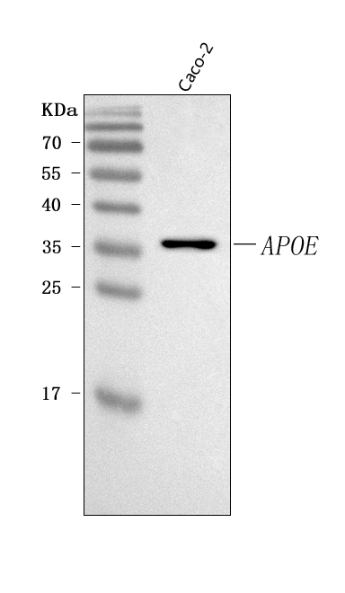  Western blot analysis of APOE using anti-APOE antibody (A00015-5)
