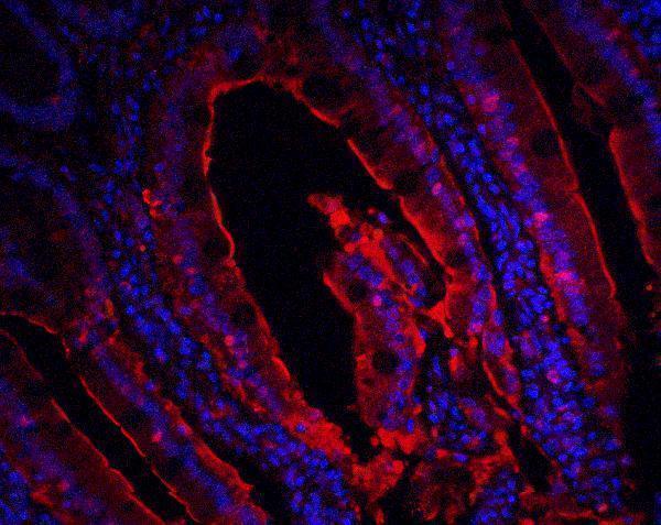 a00016 1 cdkn2a primary antibodies if testing 10