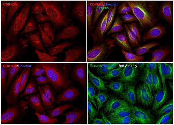 a00016 1 cdkn2a primary antibodies if testing 2