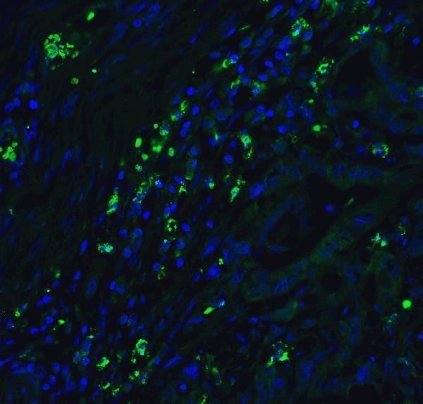 a00016 1 cdkn2a primary antibodies if testing 9