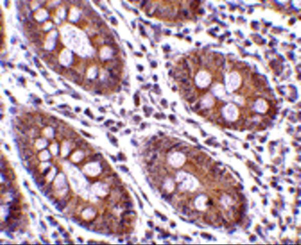 a00016 1 cdkn2a primary antibodies ihc testig 11
