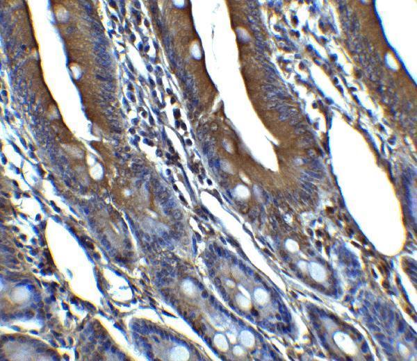 a00016 1 cdkn2a primary antibodies ihc testing 12