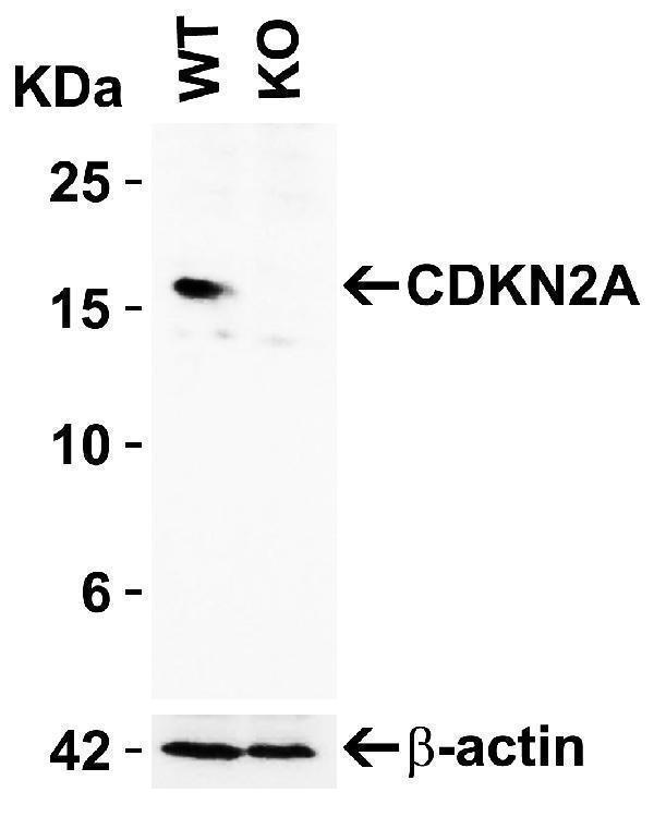 a00016 1 cdkn2a primary antibodies ko testing 1