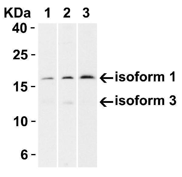 a00016 1 cdkn2a primary antibodies wb testing 6