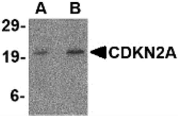 a00016 1 cdkn2a primary antibodies wb testing 7