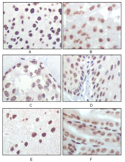Immunohistochemistry analysis of paraffin-embedded rat liver tissue (A) , human brain tumor (B) , breast cancer (C) , esophageal epithelium tissue (D) , mouse brain tissue (E) and stomach tisue (F) , showing nuclear localization with DAB staining using p16 Mon
                