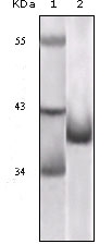 Western blot analysis using p16 monoclonal antibody against truncated p16 recombinant protein