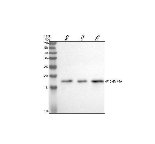  Western blot analysis of p16INK4a/CDKN2A using anti-p16INK4a/CDKN2A antibody (A00016-5)