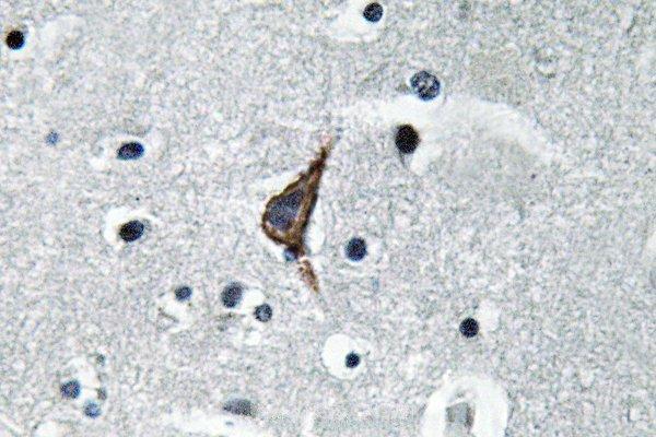 a00017s441 tlr4 primary antiboties ihc testing 2