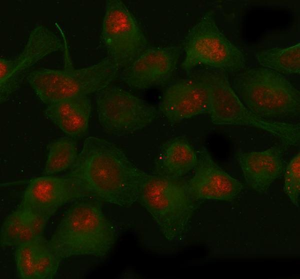  IF analysis of SIRT1 using anti-SIRT1 antibody (A00018-1) and anti-Beta Tubulin antibody (M01857-3)