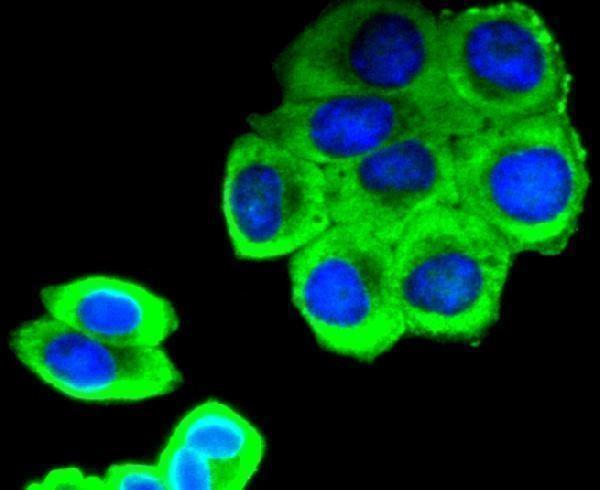 ICC staining SIRT1(phospho S47) in HepG2 cells (green)