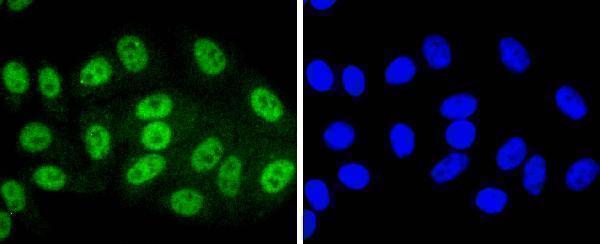 ICC staining Phospho-SIRT1(T530) in HepG2 cells (green)