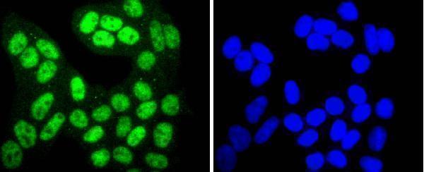 ICC staining Phospho-SIRT1(T530) in Hela cells (green)