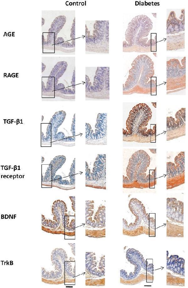 The representative samples of immunohistochemical staining for AGE, RAGE, TGF-β1, TGF- β1 receptor, BDNF and TrkB in the colon wall of two groups