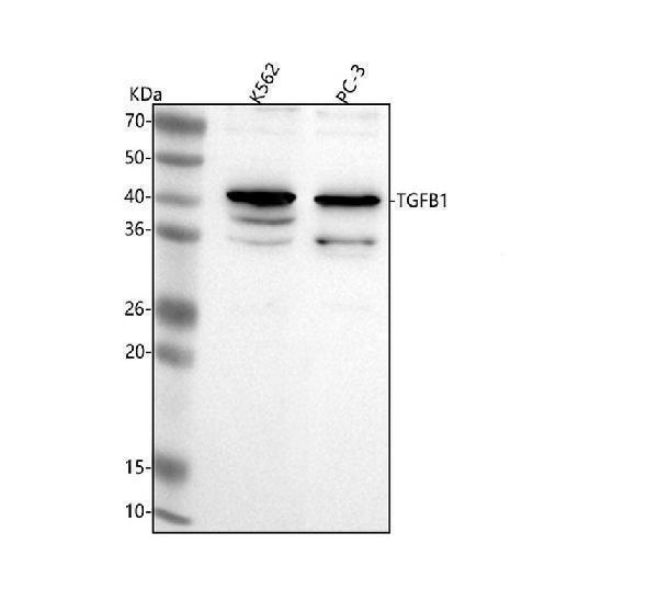  Western blot analysis of TGF Beta 1/TGFB1 using anti-TGF Beta 1/TGFB1 antibody (A00019-3)
