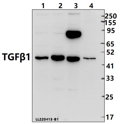 Western blot (WB) analysis of TGFβ1 (Y369) pAb at 1:5000 dilution
Lane1:C6 whole cell lysate(40ug)
Lane2:BV2 whole cell lysate(40ug)
Lane3:A549 whole cell lysate(40ug)
Lane4:Hela whole cell lysate(40ug)