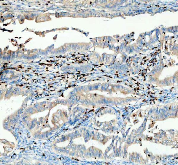  IHC analysis of CTLA4 using anti-CTLA4 antibody (A00020-2)