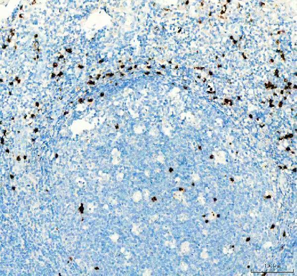  IHC analysis of CTLA4 using anti-CTLA4 antibody (A00020-2)