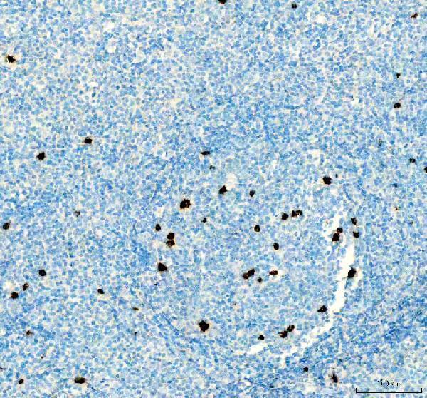  IHC analysis of CTLA4 using anti-CTLA4 antibody (A00020-2)