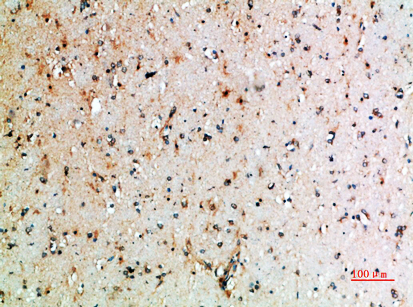Immunohistochemical analysis of paraffin-embedded human-brain, antibody was diluted at 1:200
