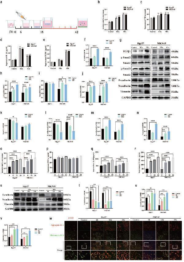 The effect of M2 subtype macrophages on TGFβ1 related pathway and epithelial mesenchymal transition in gastric cancer cells