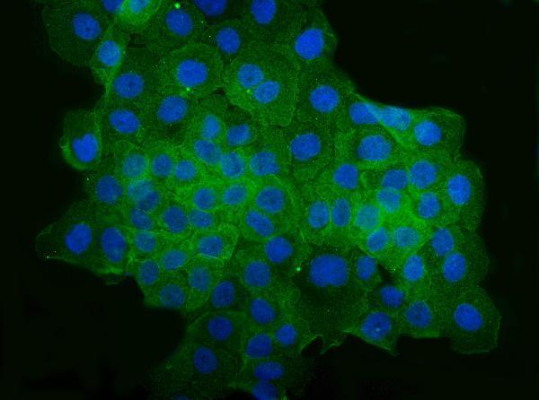 a00022 2 bcr primary antibodies if testing 1