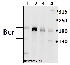 Western blot (WB) analysis of Bcr (D171) polyclonal antibody at 1:500 dilution
Lane1:AML-12 whole cell lysate(40ug)
Lane2:PC12 whole cell lysate(40ug)
Lane3:MCF-7 whole cell lysate(40ug)
Lane4:HepG2 whole cell lysate(40ug)