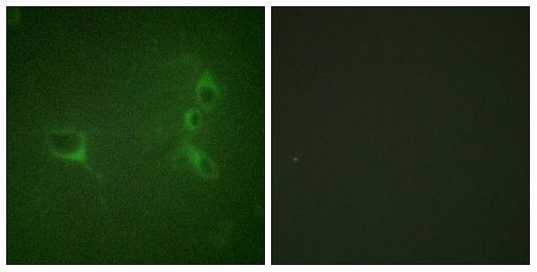 a00022y360 bcr primary antibodies if testing 4