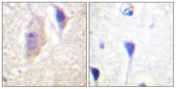 a00022y360 bcr primary antibodies ihc testing 3