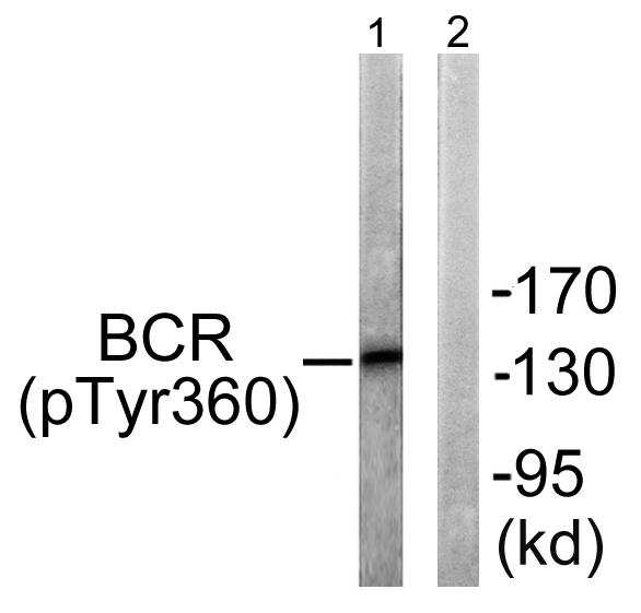 a00022y360 bcr primary antibodies wb testing 2