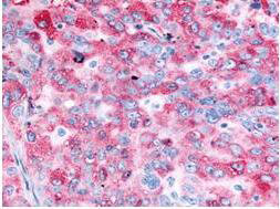a00023 1 egfr primary antibodies ihc testing 1